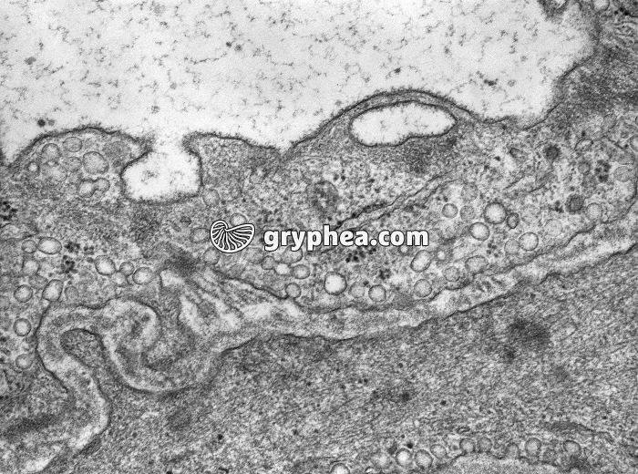 Vésicules de pinocytose (endothelium d'un capillaire sanguin) MET x35000 - gryphea.org
